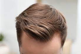 Factors Influencing Hair Transplant Prices in Turkey